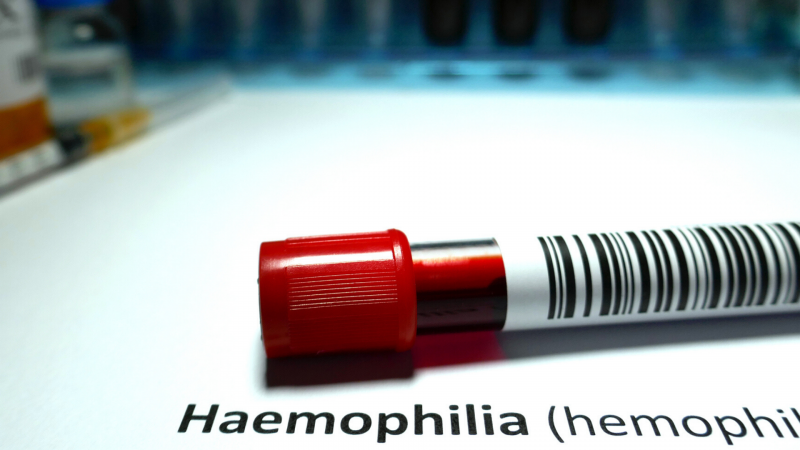 Cantabria subvencionará un tratamiento para la hemofilia - escuchar ahora