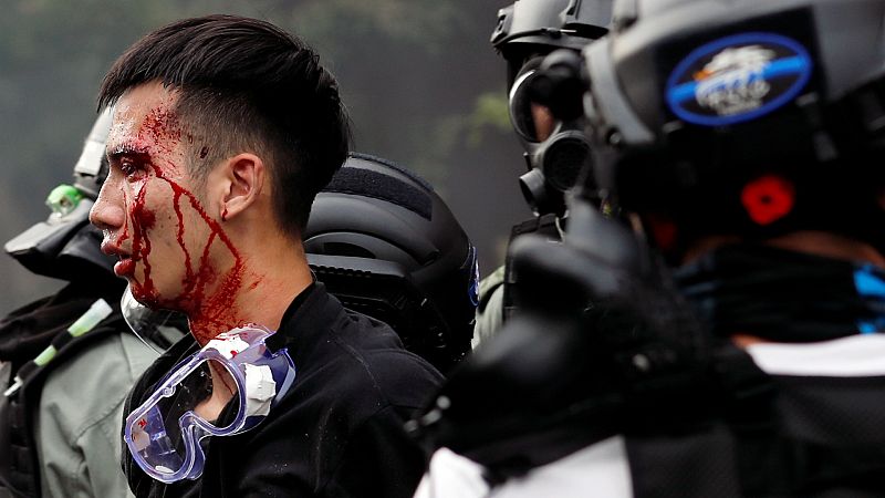 Todo Noticias - Mañana - Varios heridos detenidos en las manifestaciones Hong Kong - Escuchar ahora