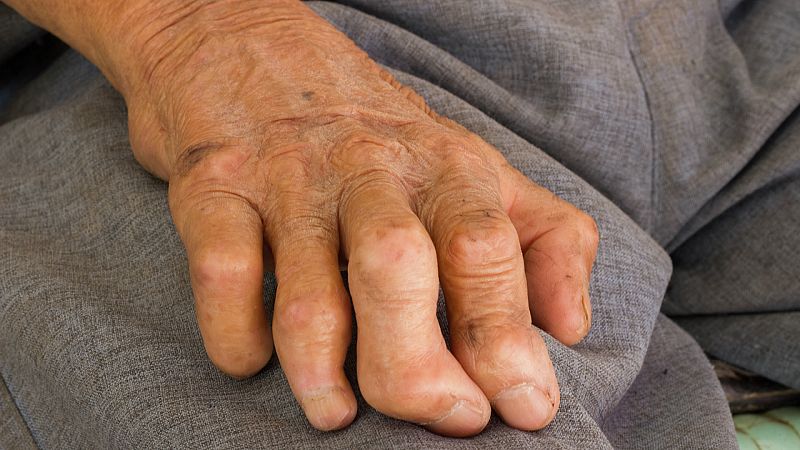 A su salud - Fundación Fontilles: luchando contra la lepra - 24/01/20 - Escuchar ahora