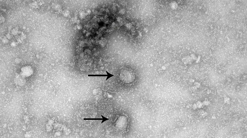 Científicos italianos  aislan la secuencia genética del coronavirus - Escuchar ahora