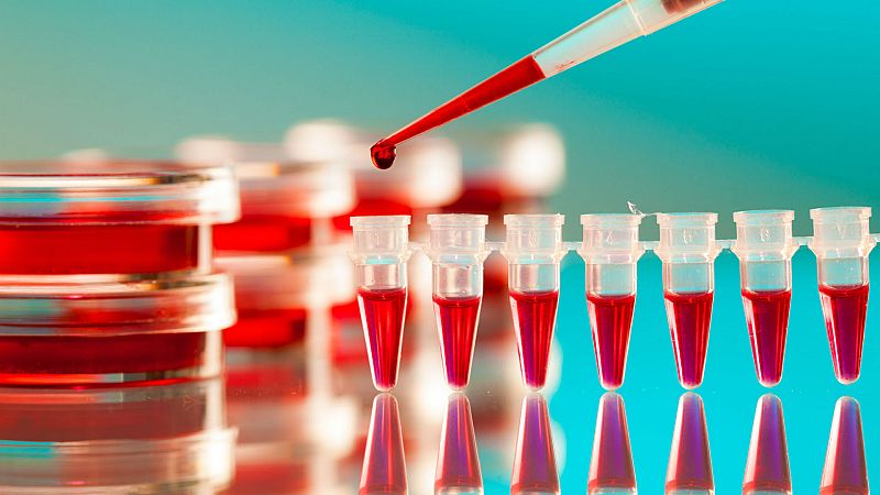 Boletines RNE - Nuevo avance en la lucha contra el sida por investigadores españoles - Escuchar ahora 