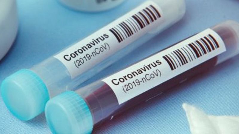 14 horas fin de semana - Un ensayo clínico de investigación compartida en Andalucía para vencer al coronavirus - Escuchar ahora