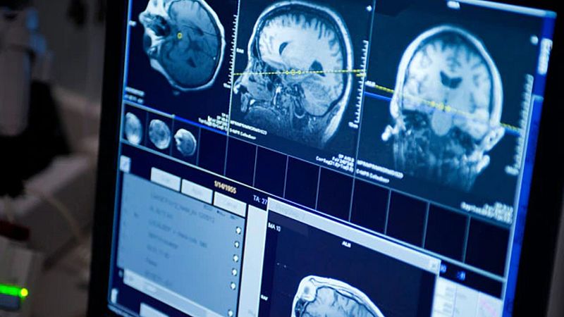 El laboratorio de JAL - Nanopartículas contra la inflamación cerebral - 14/06/20 - Escuchar ahora