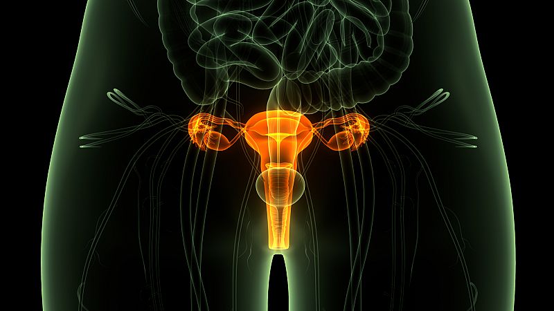  África hoy - La mortalidad por cáncer de cérvix en África multiplica por 10 la de España - 08/04/21 - escuchar ahora