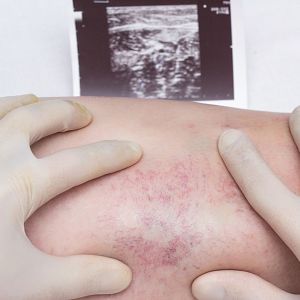 El español urgente con FundéuRAE - El español urgente con Fundéu RAE - 'Trombo' frente a 'coágulo' - 12/04/21 - Escuchar ahora