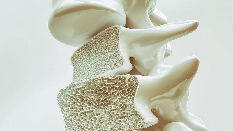 A su salud - Día Mundial de la Osteoporosis - 22/10/21 - Escuchar ahora