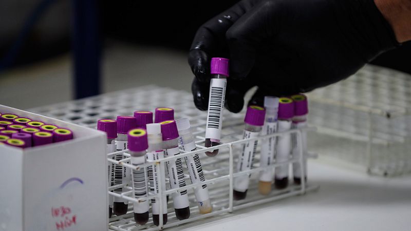 Las mañanas de RNE con Íñigo Alfonso - La ciencia, cada vez más cerca de la vacuna contra el VIH - Escuchar ahora