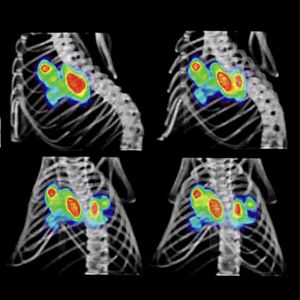 A golpe de bit - A golpe de bit - Descubren fármaco que frena la metástasis en cáncer de mama - 25/02/22 - escuchar ahora