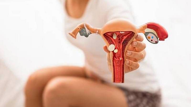 L'endometriosi: una malaltia silenciada i desconeguda