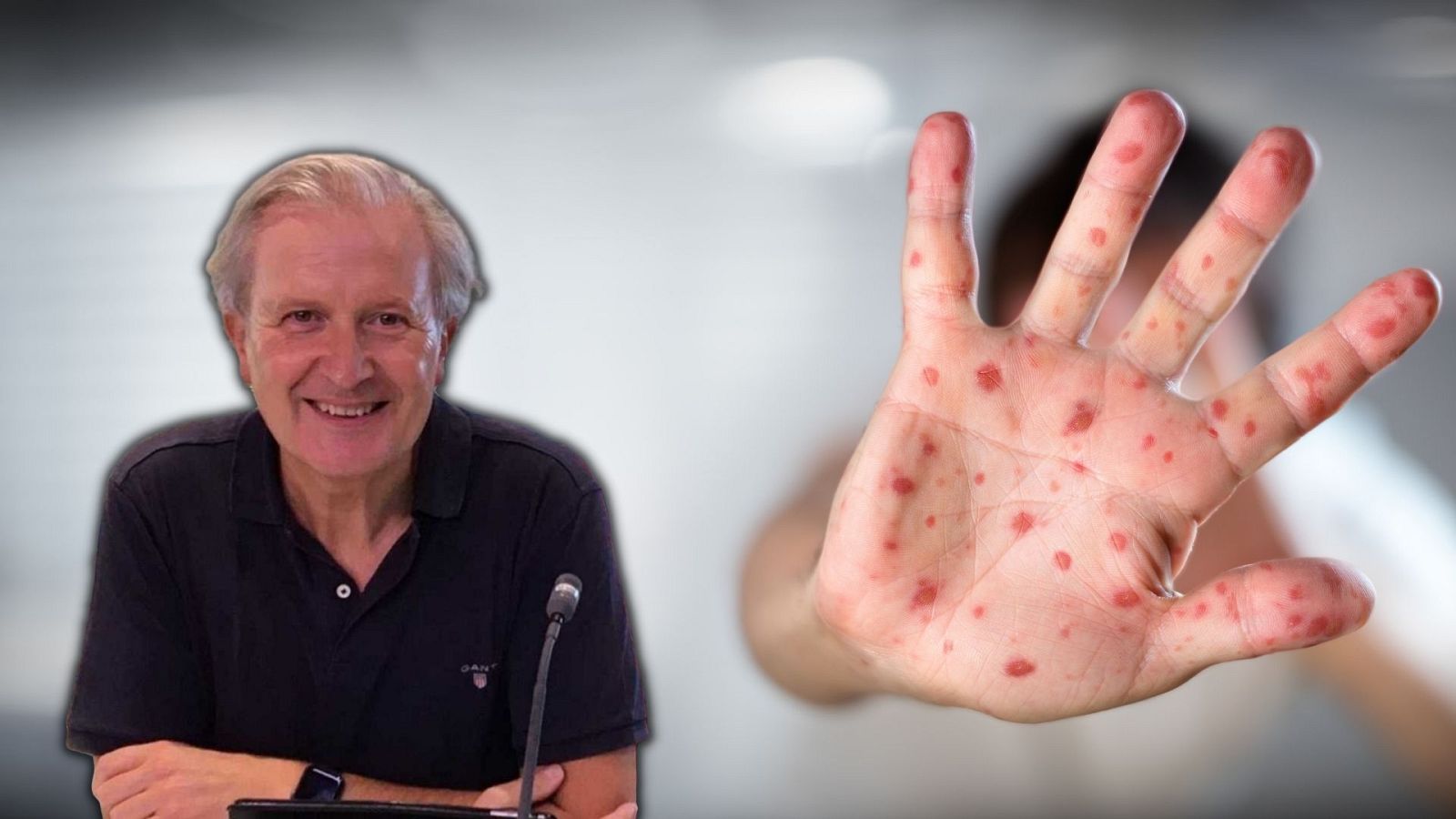 Las mañanas de RNE con Pepa Fernández - Verba Volant: Viruela y cernícalos - 27/05/22 - Escuchar ahora