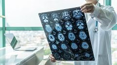 Entre probetas - Una comunidad decidida contra el Alzheimer - 31/05/22