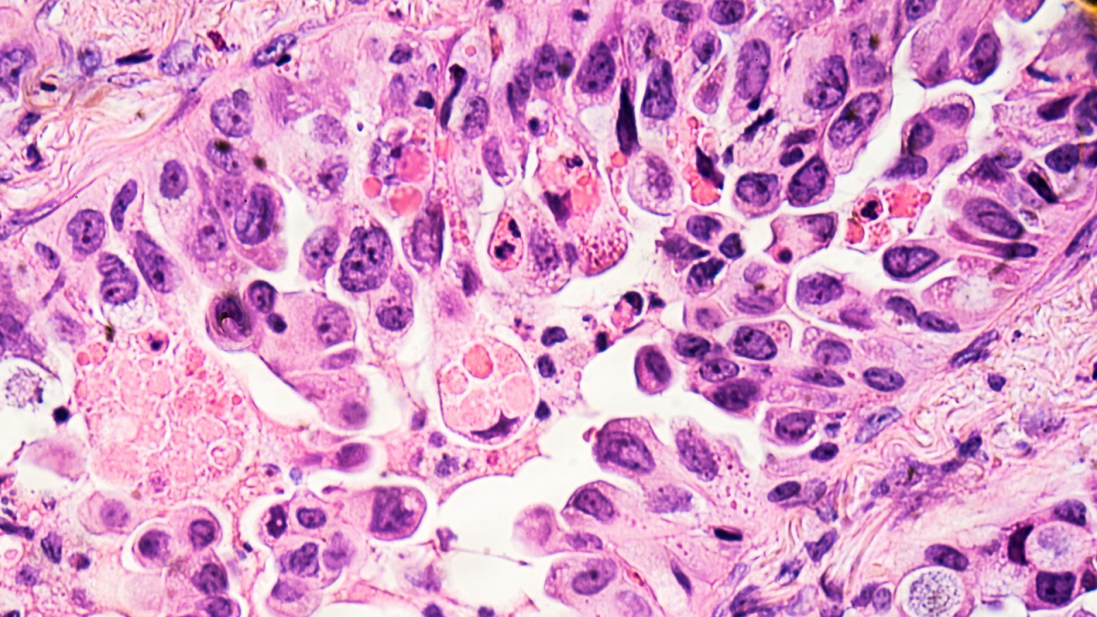 Por tres razones - Antoni Ribas: "soy optimista, el cáncer es controlable" - Escuchar ahora