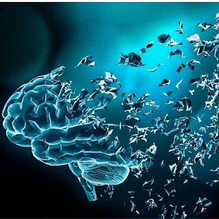 D�a del Alzheimer con el catedr�tico �lvaro Pascual-Leone