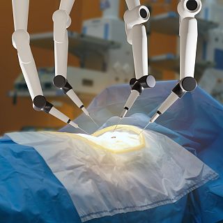 Espa�a l�der en cirug�a rob�tica urol�gica