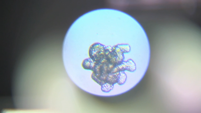 24 horas - Identifican las células responsables de la recaída en el cáncer de colon: "Estamos investigando si están presentes en otros tipos de tumor" - Escuchar ahora