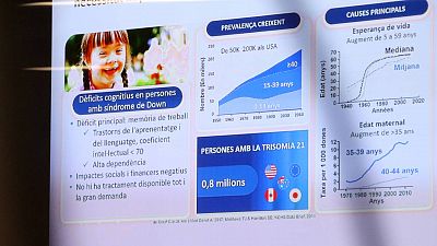 Arrenca l'assaig clínic d'un medicament per millorar la funció cognitiva de persones amb la síndrome de Down