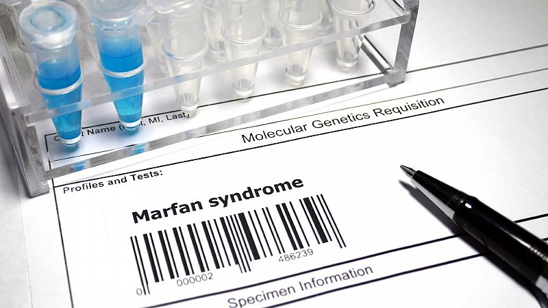 Memoria de delfín - Síndrome de Marfan: un diagnóstico inesperado - 12/12/22 - escuchar ahora