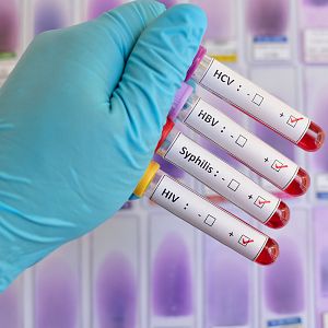 Entre probetas - Entre probetas - Enfermedades de transmisión sexual - 17/01/23 - Escuchar ahora