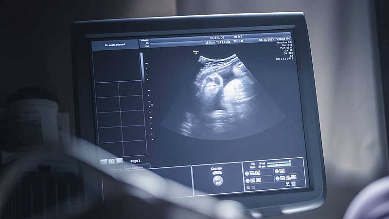 24 horas - Txantón Martínez-Astorquiza, presidente de SEGO: "El 90% de los abortos son ambulatorios" - Escuchar ahora