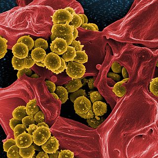 Nuevos estudios en multirresistencia bacteriana