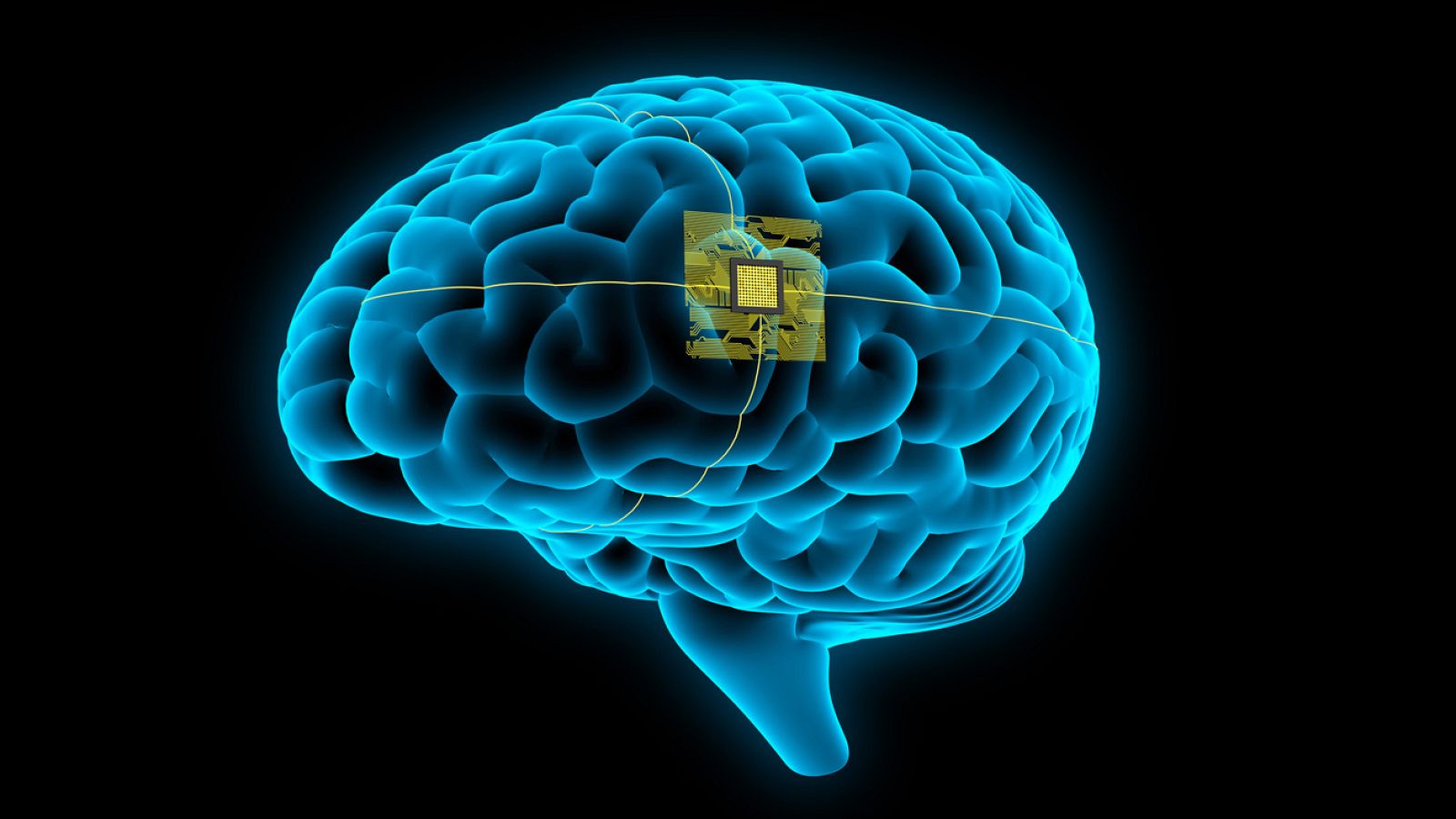 A golpe de bit - Dr. Láinez: "El futuro es el implante cerebral" - 19/06/23 - escuchar ahora