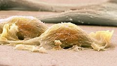 Marca España - Diagnóstico precoz e investigación, claves contra el sarcoma - 11/07/23