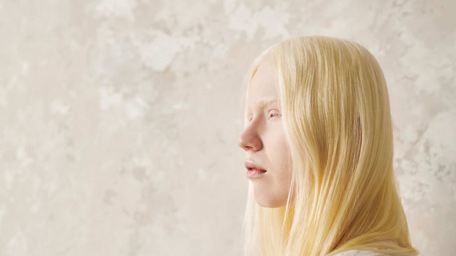 Para que veas - Ricardo: con 7 meses me diagnosticaron albinismo - 12/07/23 - Escuchar ahora