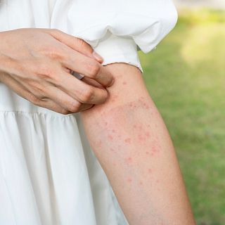 Come sano y calla en Radio 5