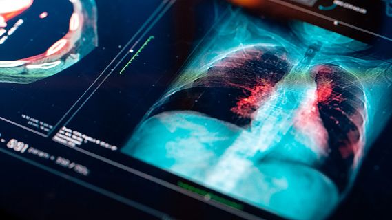 Serveis informatius Ràdio 4