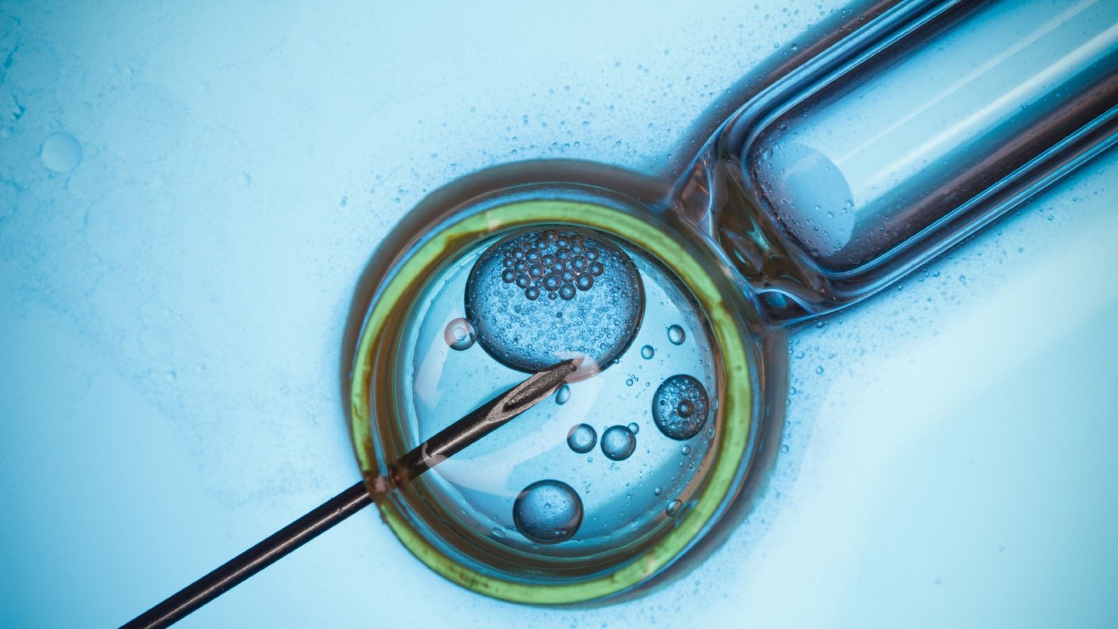 Barcelona és puntera en clíniques de fertilitat | NÚRIA ALCALÁ