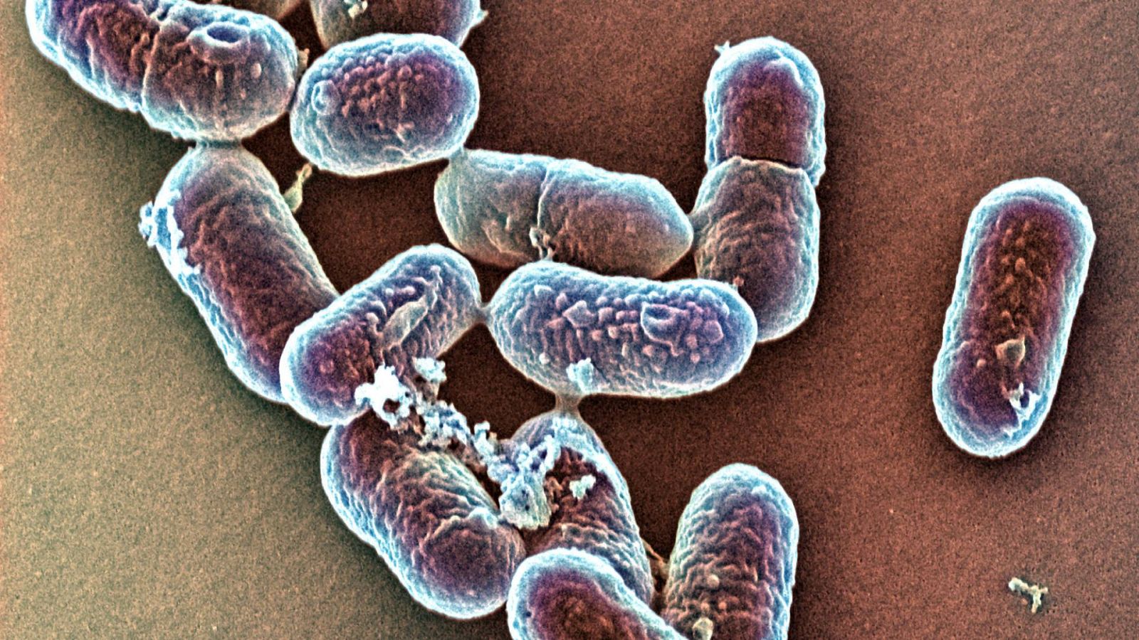 El gallo que no cesa - La ciencia que hay en ti: Bacterias y antibióticos - Escuchar ahora