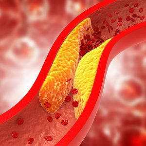 Vida sana con Julio Basulto - Gente Despierta - Todo lo que debes saber sobre el colesterol - Escuchar ahora