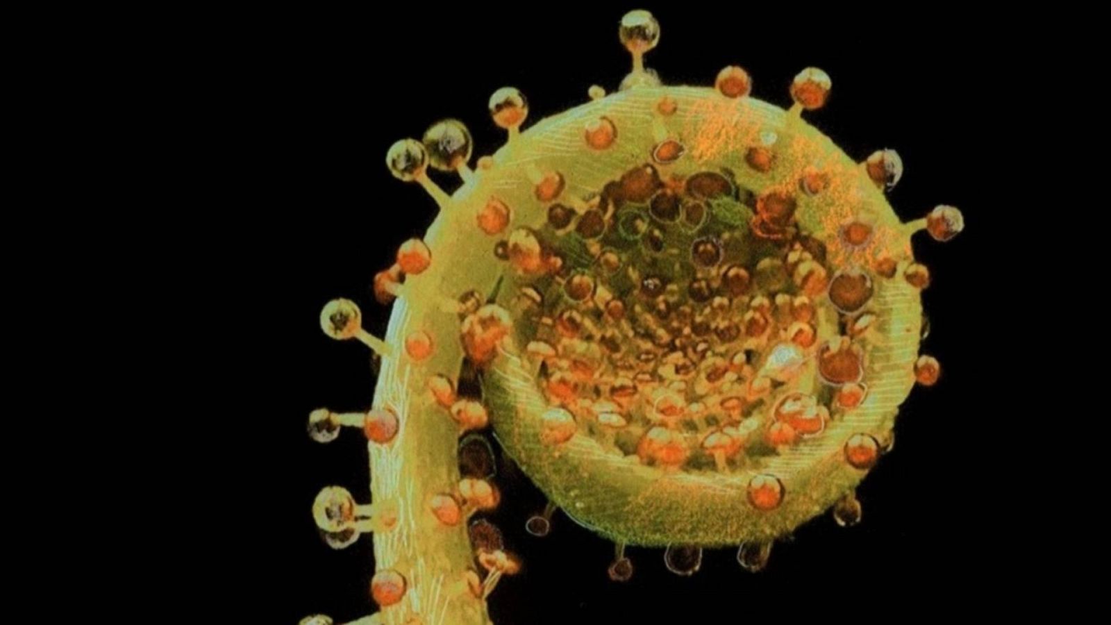 Reserva natural - 'La recivilización' y 'Plantae' - 21/09/23 - Escuchar ahora