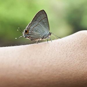 Memoria de delfín - Memoria de delfín -  Piel de mariposa: genética, degenerativa e incurable - Escuchar ahora