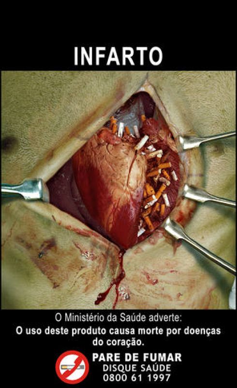  Cigarrillos en el corazón
