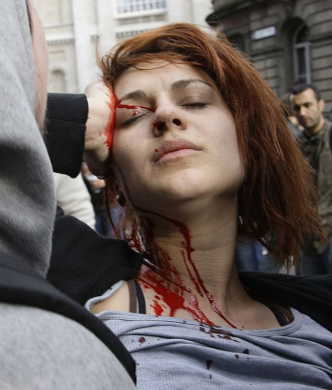 People carry an injured demonstrator during a protest near the Bank of England in London