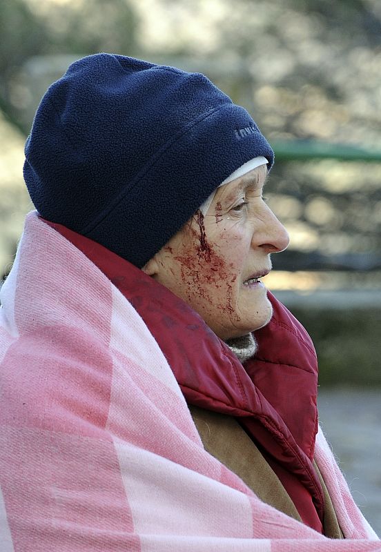 An injured woman sits on a street after an earthquake in Aquila