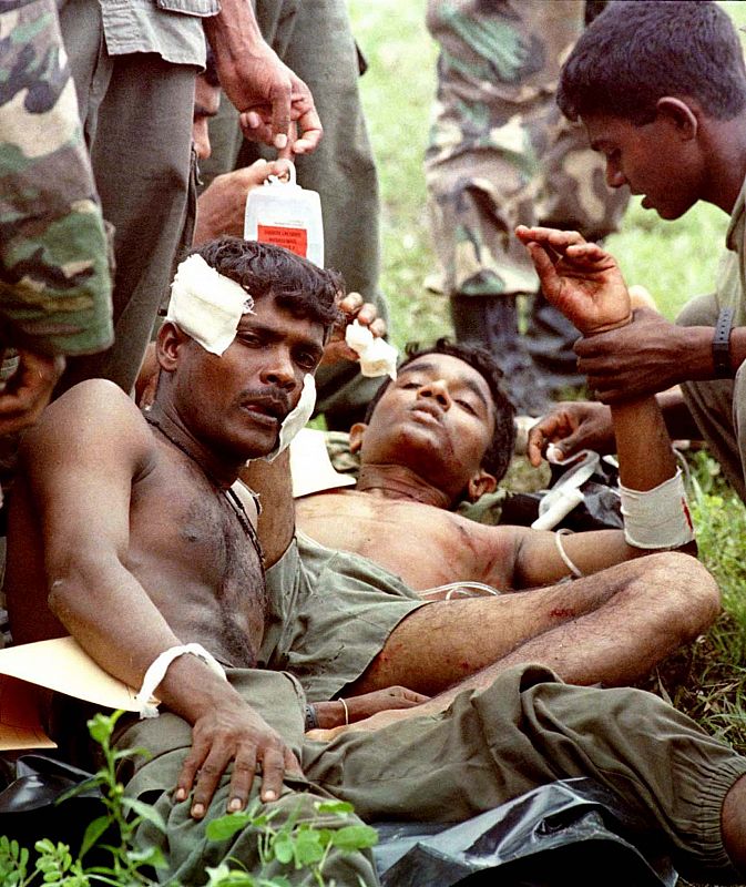 Un soldado del ejército heridos tras un ataque de los rebeldes.