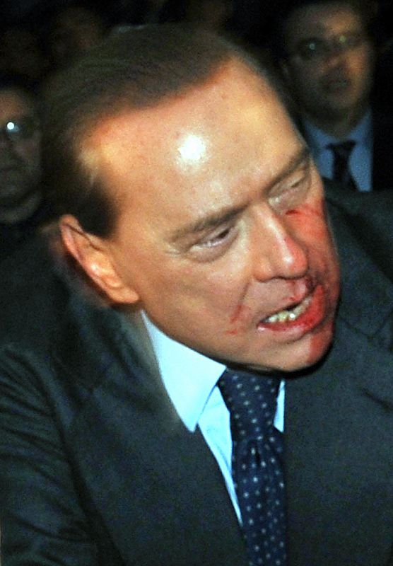 Berlusconi, agredido