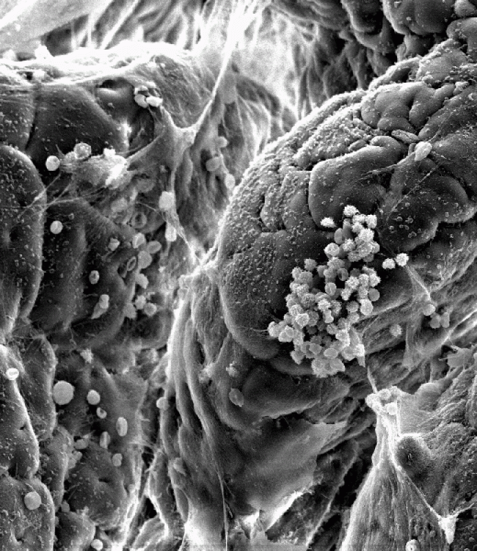 Premio votación popular categoría Micro. Mención honorífica. Sobrevolando el intestino. La superficie del intestino delgado se descubre en esta fotografía obtenida mediante microscopía electrónica de barrido. La visión aérea que proporciona esta téc