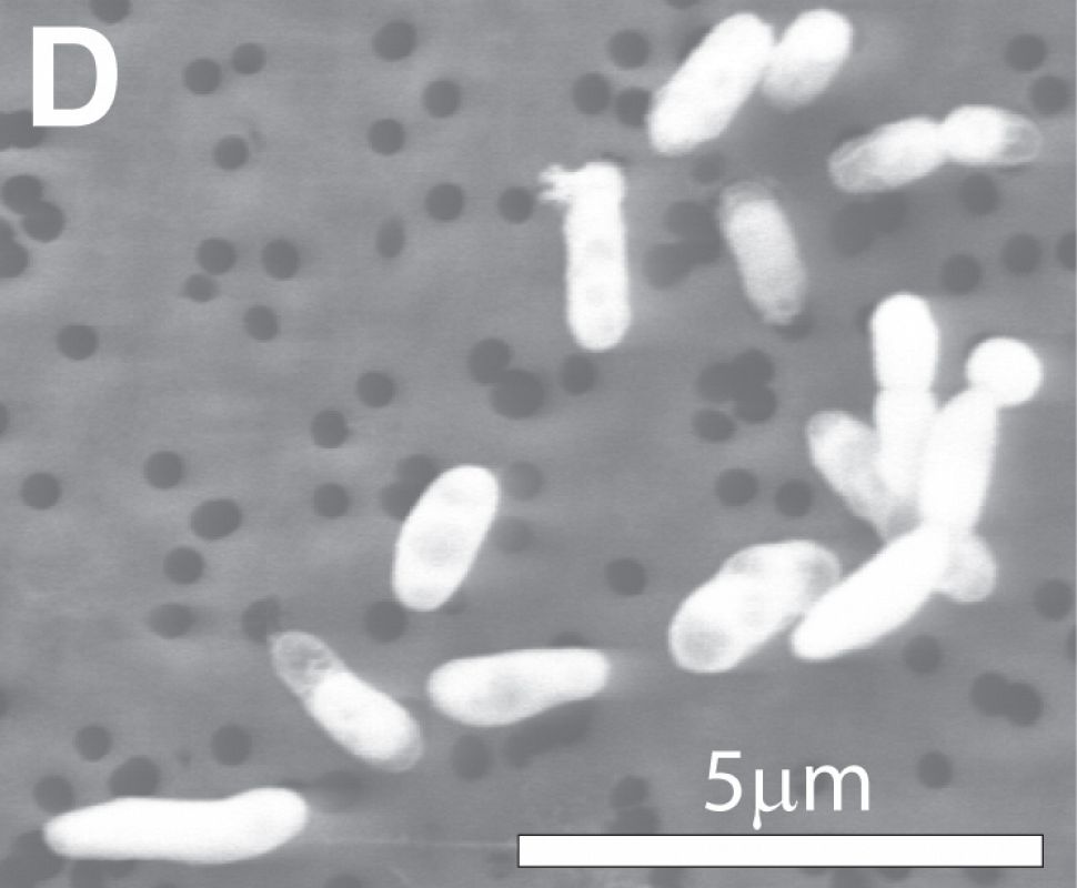 Descubrieron que la 'superbacteria' tiene la sorprendente capacidad de sustituir completamente el fósforo por arsénico en sus moléculas, hasta llegar incluso a incorporarlo a su ADN.