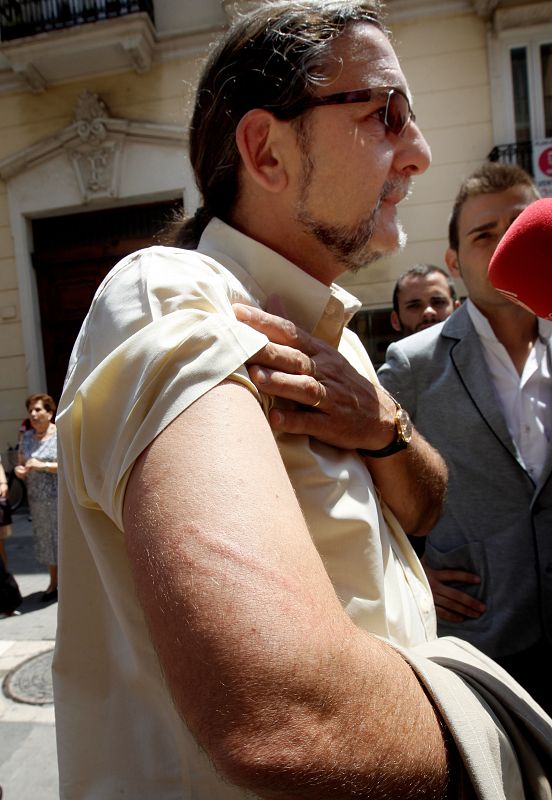 Juan Ponce, diputado del grupo Compromís, muestra la marca en su brazo de un porrazo durante la carga policial contra los "indignados" del movimiento 15-M