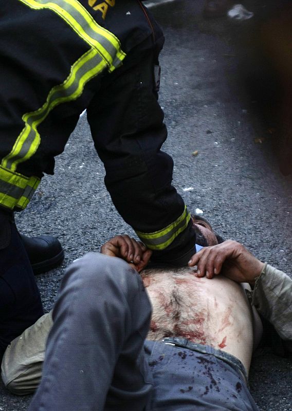 Un manifestante es atendido después de haber recibido un golpe en la cabeza