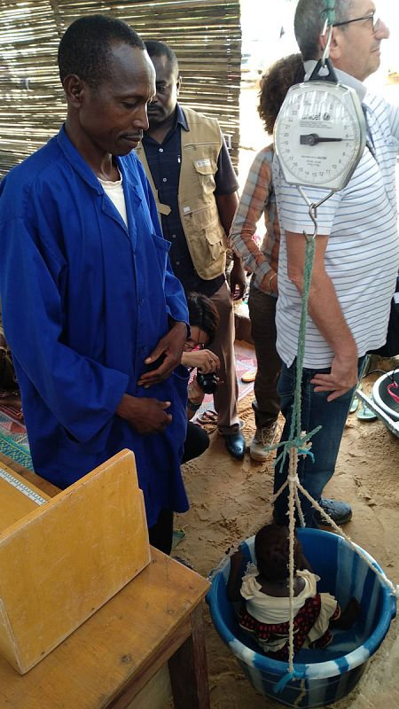 La niña que por el sistema de medición braquial presenta síntomas de desnutrición es pesada por los profesionales sanitarios.