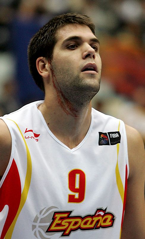 El jugador de la selección española de baloncesto Felipe Reyes, sangra tras un golpe sufrido en el partido de semifinales del Mundial 2006 en Japón