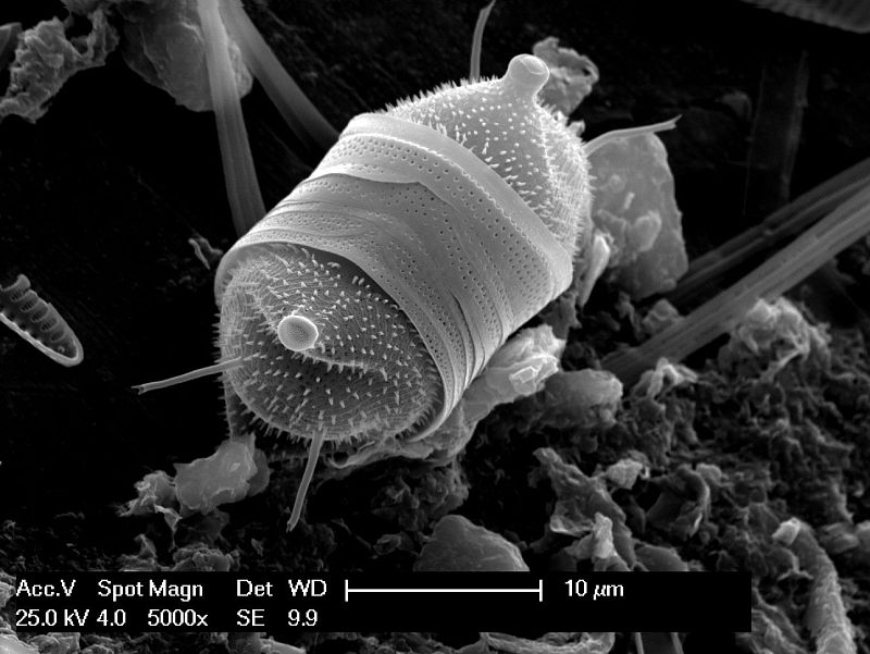 El universo microscópico de las diatomeas.