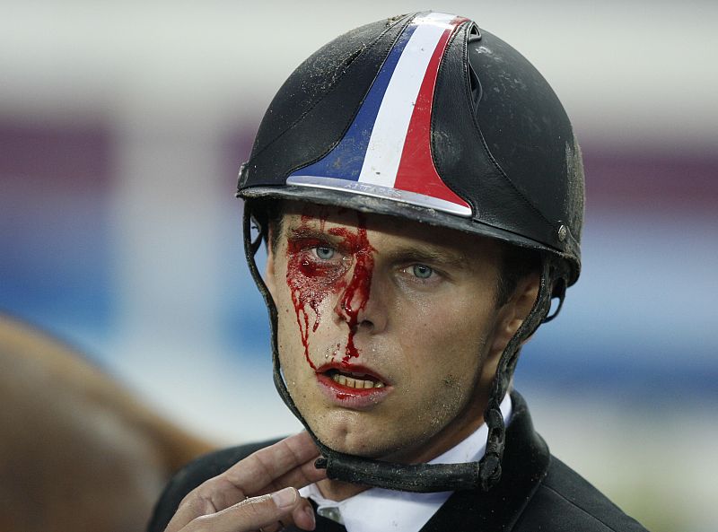 Zakrzewski of France has blood on his face after falling from his horse DianDian during the men's riding show jumping event of the modern pentathlon competition at the Beijing 2008 Olympic Games