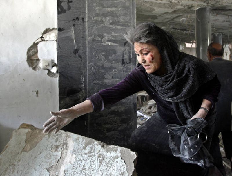 Inured Afghan woman points to wounded colleague inside the Ministry of Information and Culture in Kabul