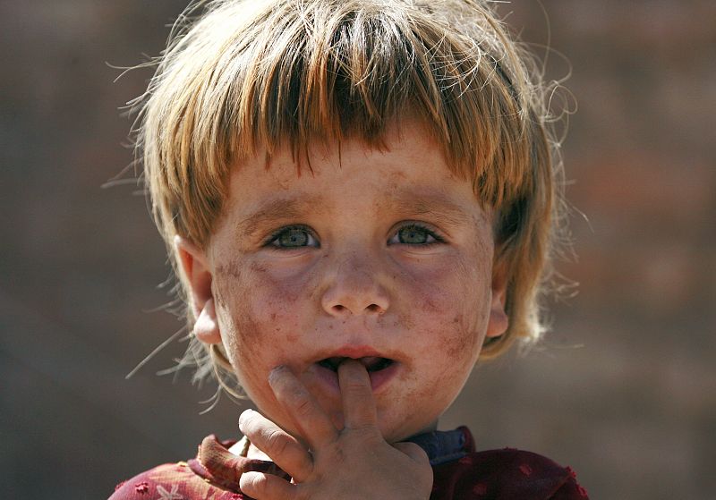 Gulruch, 3, an internally displaced child escaping military operations in Swat vally , takes shelter at a UNHCR camp, in the outskirts of Peshawar