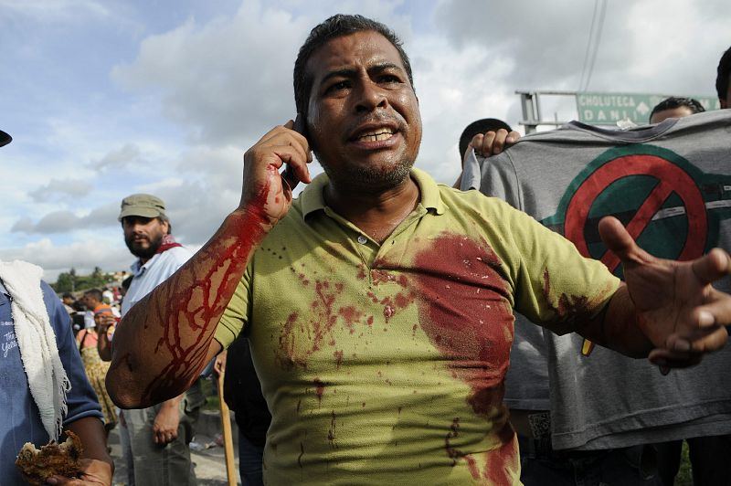 Un hombre con la camisa ensangrentada habla por telefono en el momento en que seguidores del depuesto presidente Manuel Zelaya se enfrentan a policías y soldados en el aeropuerto internacional de Toncontín.